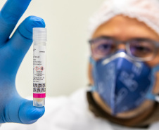  Lacen processa 13.298 amostras para vírus respiratórios em seis meses