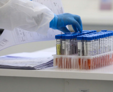 Paraná é o segundo estado em quantidade de exames RT-PCR. Foto: Geraldo Bubniak/AEN