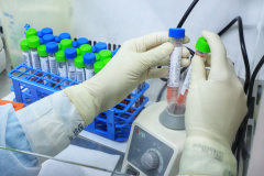 O Laboratório de Análises Clínicas do Hospital Universitário Regional de Maringá (LAC-HUM) já realizou, desde o início da pandemia até a segunda semana de agosto de 2021, quase seis mil testes para detectar a presença do novo coronavírus
Foto: José Fernando Ogura/AEN